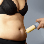 Liposuction Cost Knowing How Much Liposuction Will Cost You