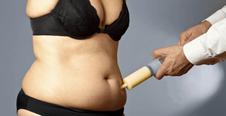 Liposuction Cost Knowing How Much Liposuction Will Cost You