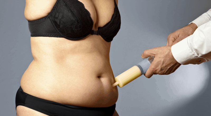 Liposuction Cost Knowing How Much Liposuction Will Cost You